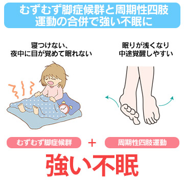 むずむず脚症候群（レストレスレッグズ症候群）
