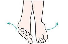 周期性四肢運動障害